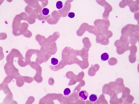 The isolated mcr-3 gene can be transferred among different bacteria in animals and humans (Credit: Thinkstock)