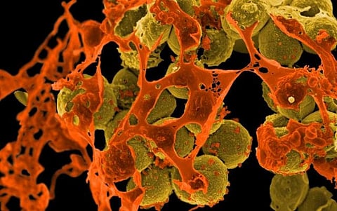 In addition to multidrug-resistant tuberculosis, WHO has identified 12 classes of priority pathogens, some of them causing common infections such as pneumonia or urinary tract infections. These are increasingly becoming resistant to existing antibiotics and are urgently in need of new treatments
Credit: NIAID