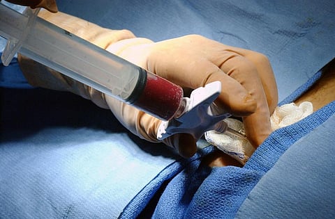 Rejuvenating stem cells from older donors make them useful for bone marrow transplantation. Credit: Wikimedia Commons