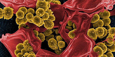 Infections that throughout the 20th century became easy to treat because of antibiotics have today become deadly.Credit: NIAID