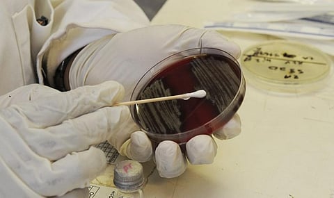 Only 123 countries have policies to regulate the sale of antimicrobials. Credit: Health.Mil