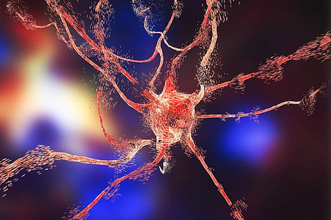 Cell death in a brain cell. Credit: Getty Images