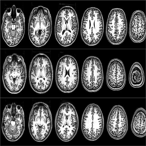 The neuroscience of terrorism: how we convinced a group of radicals to let us scan their brains