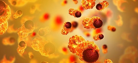 Decoded: What triggers spread of cancer cells