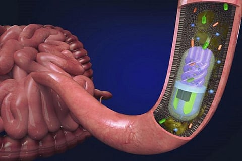 Microbiome sampling pill in the small intestine. Photo: Nano Lab, Tufts University