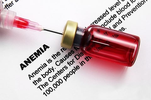 The inflammation-induced anaemia occurs due to shorter life span of red blood cells. Photo: Getty Images