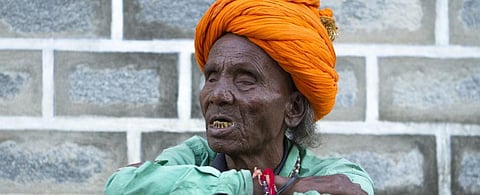 Cataract top cause of blindness in India, finds survey