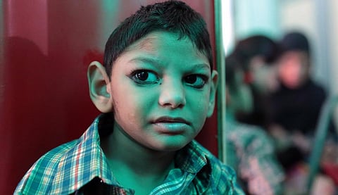 A child affected due to the Bhopal Gas Tragedy. Photo: Vikas Choudhary