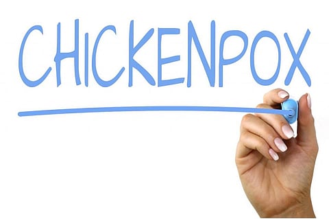 Study finds mechanism for mother-child transmission of immunity to chickenpox
