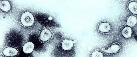 Second case of Coronavirus confirmed in the US