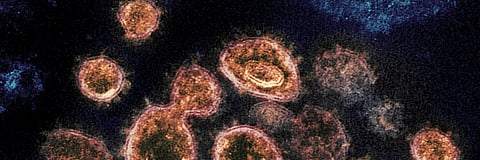 COVID-19: An infected person may infect others till 22 days