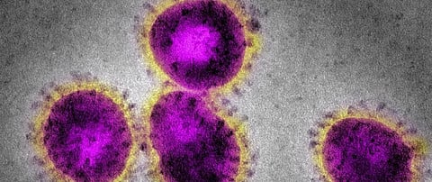 Coronavirus update: Kolkata death takes India toll to 8