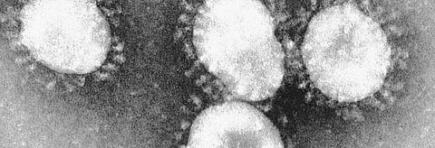 Coronavirus update: Pakistan tally at 1,000