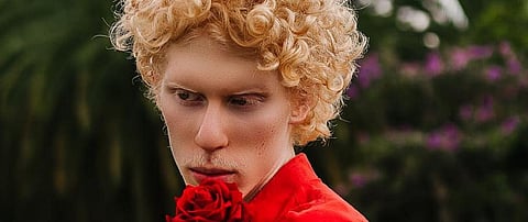 The physical appearance of those with albinism is often conflated with erroneous beliefs and myths influenced by superstition, something that furthers marginalisation and social exclusion, leading to stigma and discrimination Photo: Wallpaper Flare