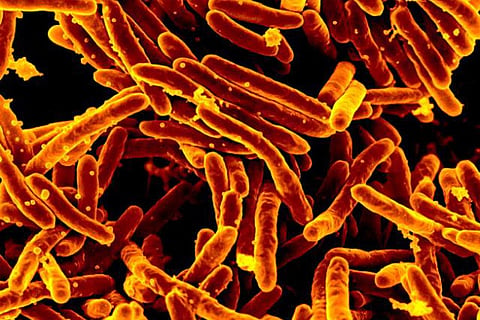 Mycobacterium abscessus