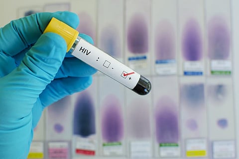 Here’s where efforts to end HIV in eastern and southern Africa must focus