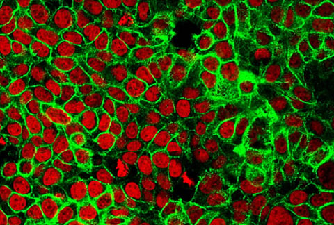 Scientists discover a new way to detect early colon cancer