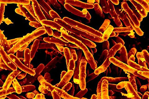 COVID-19 added over $290 billion to the global cost of TB deaths: Study