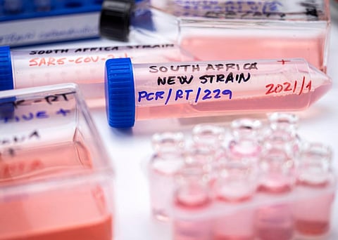 COVID-19: It’s time to look at the finer details of South Africa’s pandemic picture