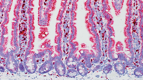 A microscopic image of a normal mouse small intestine. Cells stained red express normal amounts of cell-surface tags (MHC-II) needed by immune cells to find threats like infections or cancer. High-fat diets reduce the levels of MHC-II tags in intestinal cells. Photo: Beyaz lab / Cold Spring Harbor Laboratory