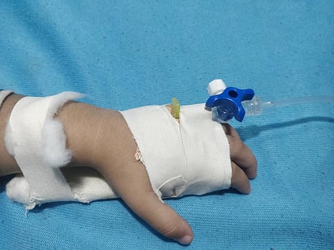 Corticosteroid can be used for effective treatment of children hospitalised with MIS-C: WHO