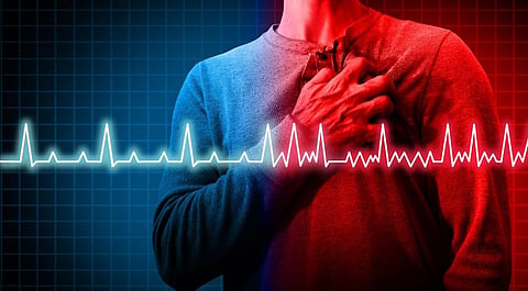 There are many types of cardiomyopathies. Dilated cardiomyopathy is the most common form. Photo: iStock