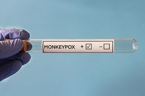 The study assessed 197 confirmed monkeypox cases between May and July 2022. Photo: iStock