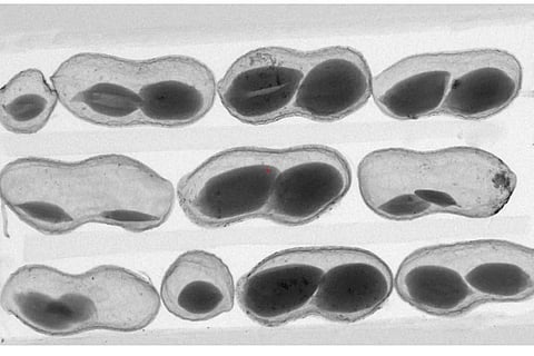 The X-ray image of peanuts. Photo: ICRISAT