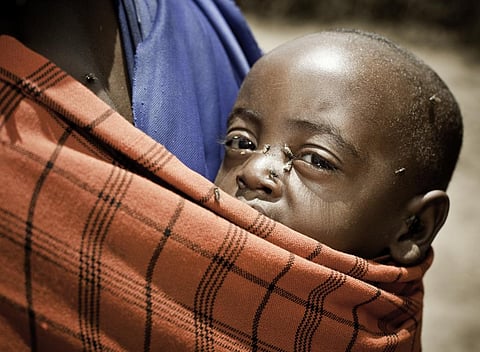 Malawi first country in southern Africa to eliminate trachoma: WHO