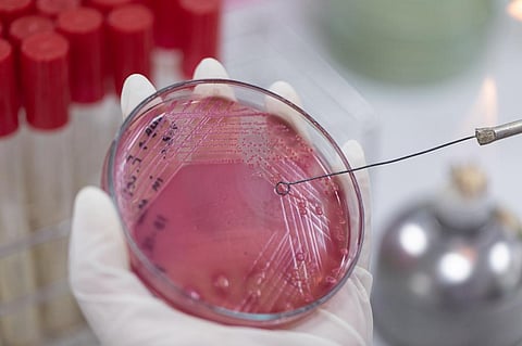 Zimbabwe was one of the first African countries to take immediate action against antimicrobial resistance. Photo: iStock