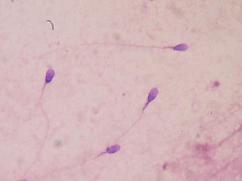Having a low sperm count can make it more difficult to conceive naturally. Photo: Wikimedia Commons