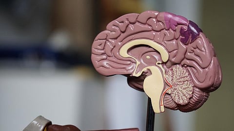Lots of ‘breakthroughs’, still no cure. Do the new dementia drugs bring us any closer?