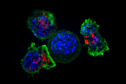 Anti-cancer CAR-T therapy reengineers T cells to kill tumors — and researchers are expanding the limited types of cancer it can target