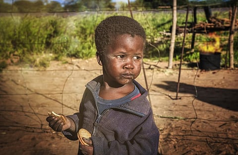 Currently, more than 30 million children in the 15 worst-affected countries suffer from or acute malnutrition and 8 million of these children are severely wasted, the deadliest form of undernutrition, said WHO. Photo: iStock