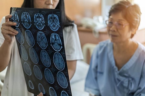 Globally, 37 nervous system conditions were ranked as the leading group cause of disability-adjusted life-years in 2021, which affected 443 million people. Photo for representation: iStock
