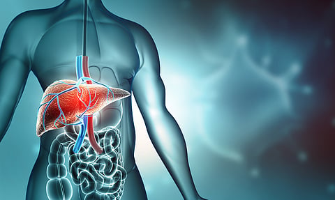 How a liver transplant helped one woman with bowel cancer become disease free