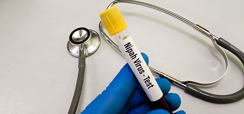 As latest Nipah case is reported in Kerala, route of virus transmission still a mystery