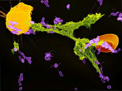 Mitochondria can sense bacteria and trigger your immune system to trap them — revealing new ways to treat infections and autoimmunity