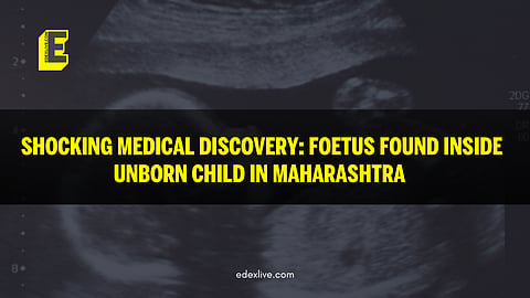 The ‘foetus-in-fetu’ condition