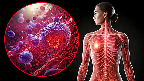 Breast cancer screening detected 558 cases during April to November 2025.