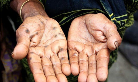 The e IISER official said, 83 blocks in eight districts of West Bengal are hit by arsenic contamination