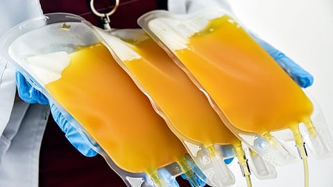 Plasma