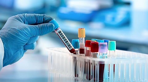 blood collection
