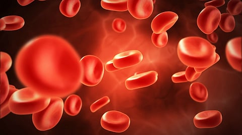Haemophilia