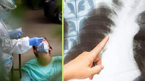 CT Scan