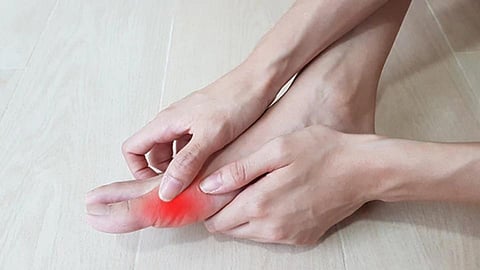 Gout