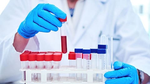 Lab Test