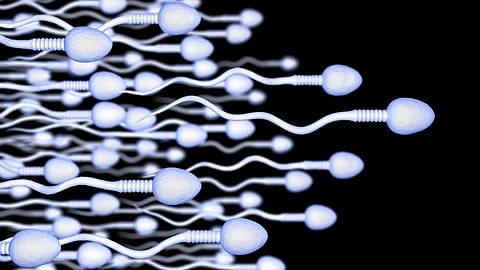 Sperm