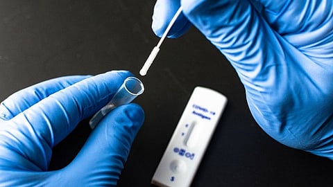 सासवडमध्ये तपासणी किटच संपले, चाचण्यांचा वेग मंदावल्याने मनस्ताप