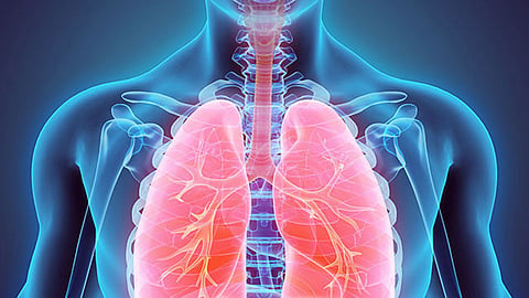 Tuberculosis